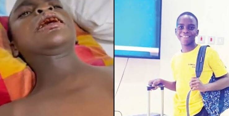 BREAKING: How Sylvester Oromoni Died — Eyewitness Doctor