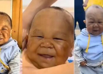 STRANGE! Meet 29-Year-Old Baby Man That Never Grew(Photos) - DAILY GIST