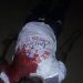 JUST IN: Yabatech Student Gunned Down On Campus