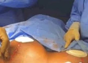 VIDEO: BBNaija Nina Ivy Shows Aftermath Effect Of Her B00b$ Reduction Surgery