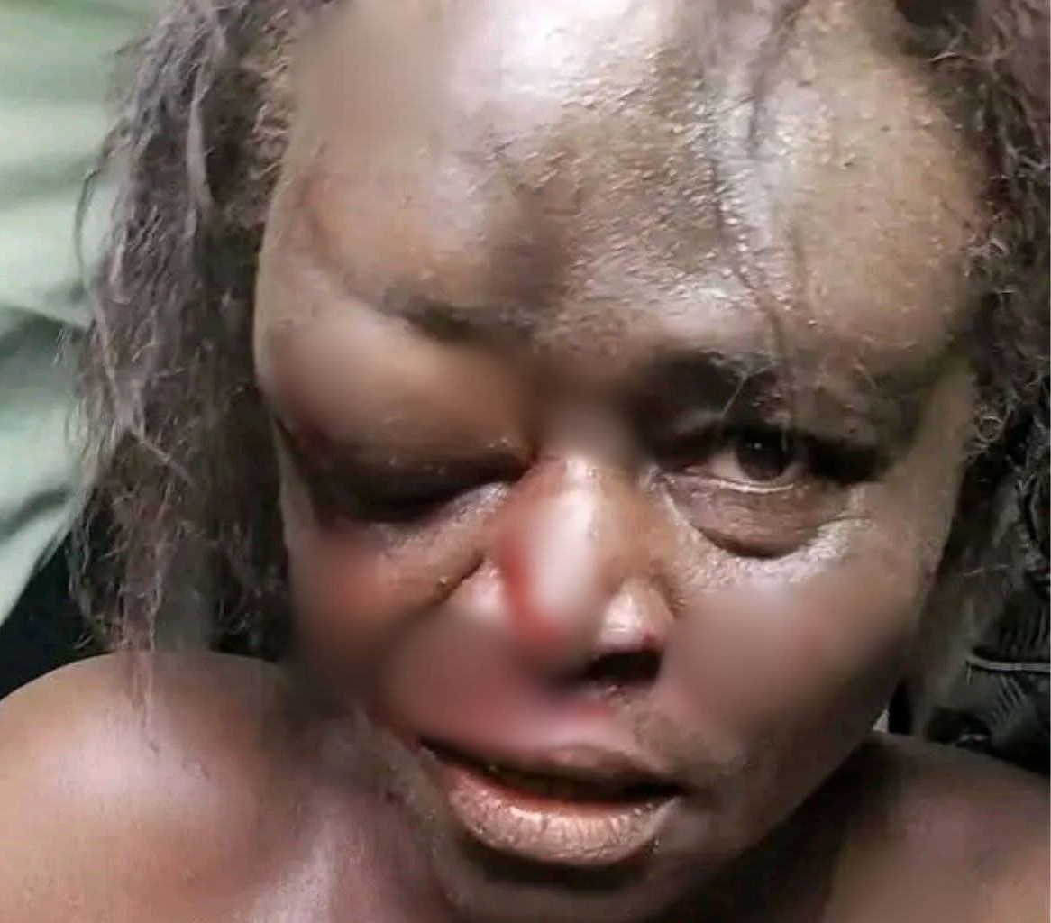 Nigerian Woman Mistaken For Kidnapper Dies After Mob Attack